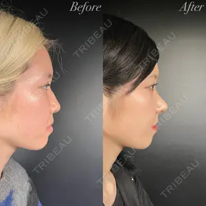 R Beauty CLINIC 大阪院 小池 泰弘医師の症例