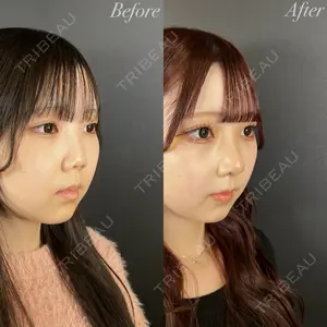 R Beauty CLINIC 大阪院 小池 泰弘医師の症例