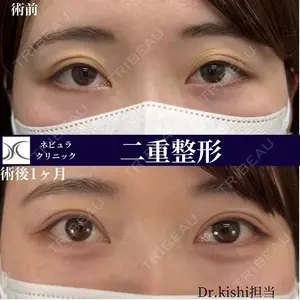 症例