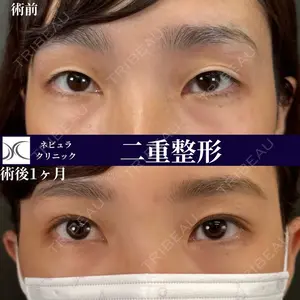 症例