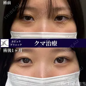 症例