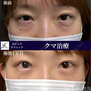 症例