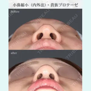 吉祥寺アイビークリニック 升本 浩紀医師の症例