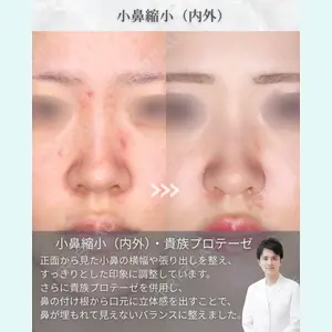 吉祥寺アイビークリニック 升本 浩紀医師の症例
