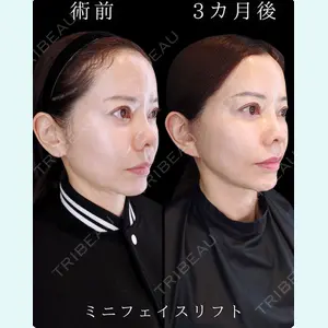 HAAB BEAUTY CLINIC 南青山本院（新院） 小平 佳典医師の症例