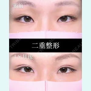 HAAB×DREAM BEAUTY CLINIC 大阪梅田院 鈴木 馨斗医師の症例