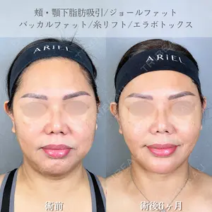 アリエル美容クリニック 大宮院 鈴木　桂介医師の症例