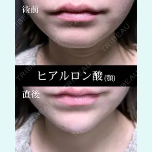 症例