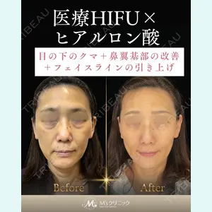 症例