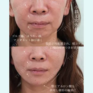 小暮整形外科・美容外科の症例