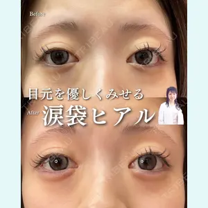ルラ美容クリニック 渋谷本院 住友 沙織医師の症例