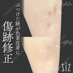 症例