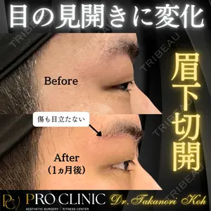 症例
