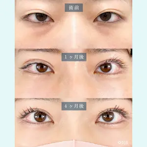 TCB東京中央美容外科 中野院の症例