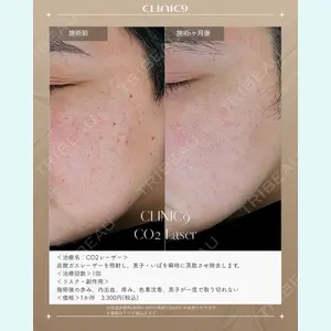 Clinic9の症例