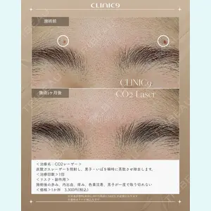Clinic9の症例
