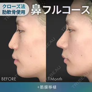 ジョウクリニック 銀座院 重本　譲医師の症例