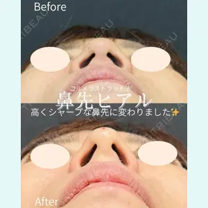 症例