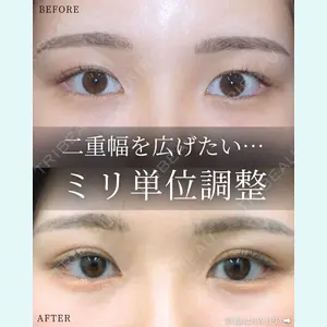症例