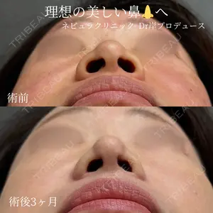 症例