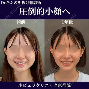 症例