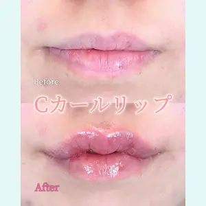 症例