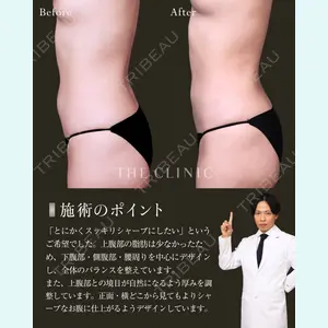 症例