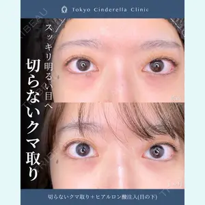症例
