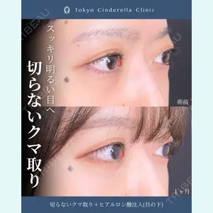 症例