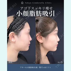 症例