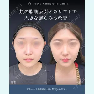 症例