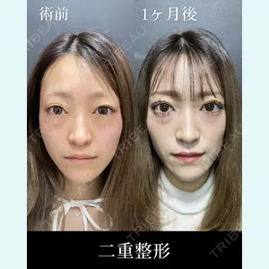 症例