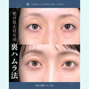症例