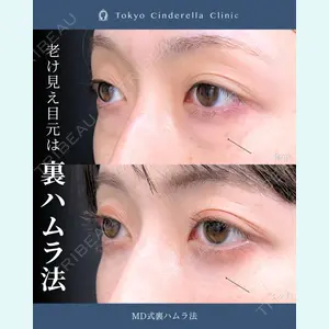 症例