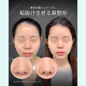 症例