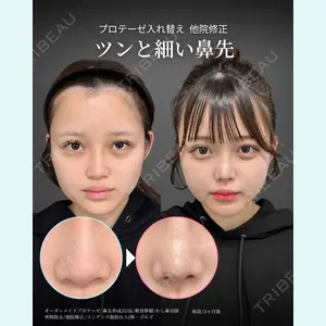 症例