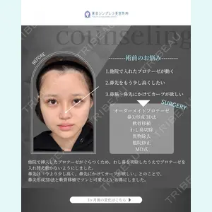 症例