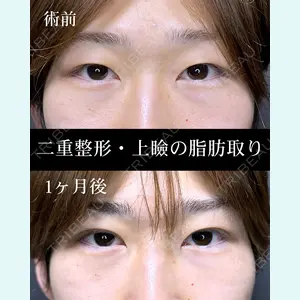 症例