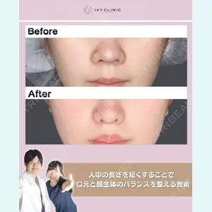 症例