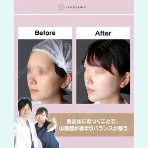 症例