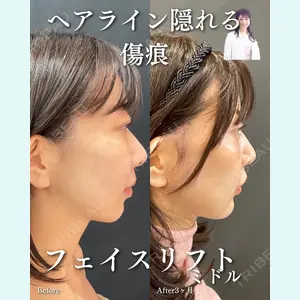 ルラ美容クリニック 渋谷本院 住友 沙織医師の症例
