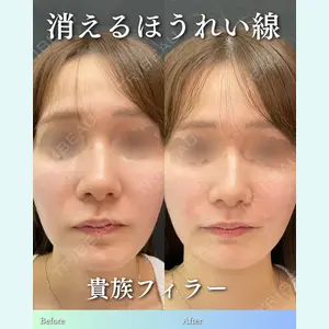 ルラ美容クリニック 渋谷本院 住友 沙織医師の症例