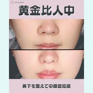 症例