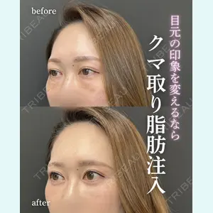 症例