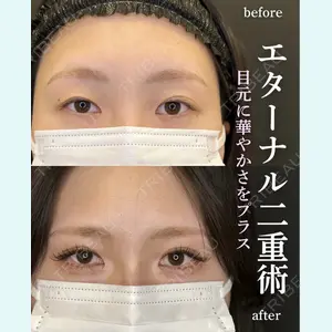 症例
