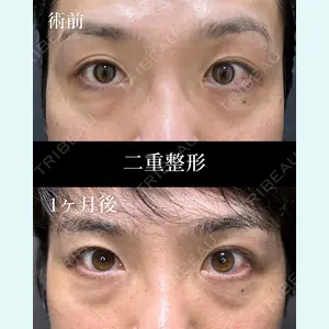 症例