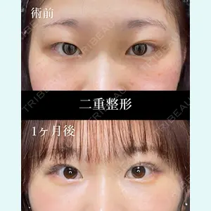 症例
