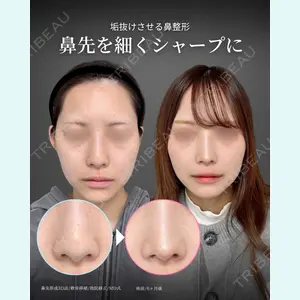 症例