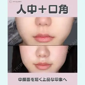 症例