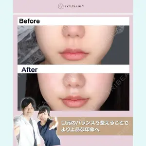 症例